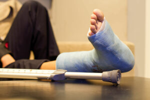 broken leg - car accident victims