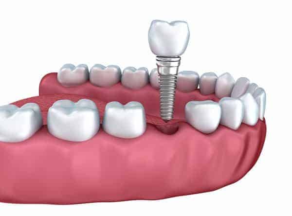 Advancements In Modern Dental Technology