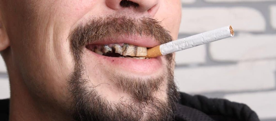 Bad-Teeth-smoker