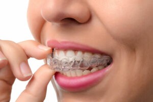 orthodontic treatment for straight teeth
